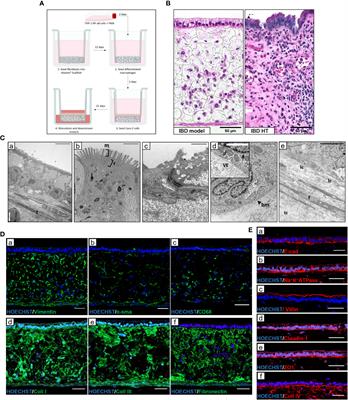 An in vitro model to study immune activation, epithelial disruption and stromal remodelling in inflammatory bowel disease and fistulising Crohn’s disease